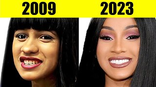 10 Most EXPENSIVE Celebrity Transformations EVER