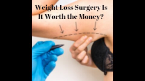 Weight Loss Surgery Is It Worth the Money?