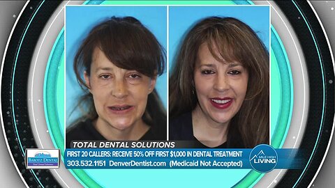 Total Dental Solutions - Barotz Dental