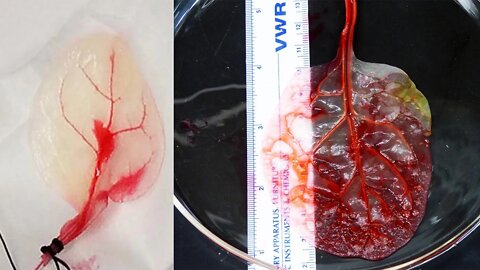 Scientists Turn SPINACH LEAVES Into BEATING Human Heart