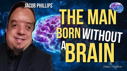 The Man Born Without A Brain: How Is He Alive? A MUST WATCH!