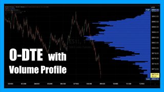 0DTE Volume Profile Analysis for September 26