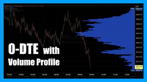 0DTE Volume Profile Analysis for September 26