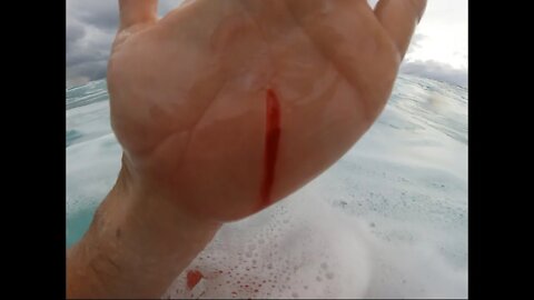 Tube coral cut my hand while surfing! Then smashed by wave!