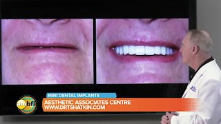 The Aesthetic Associates Center can do a mini implant and a crown in just one visit