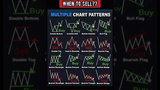 Ultimate Chart Patterns Signal You Must Know #shorts #short #viral #stockmarket