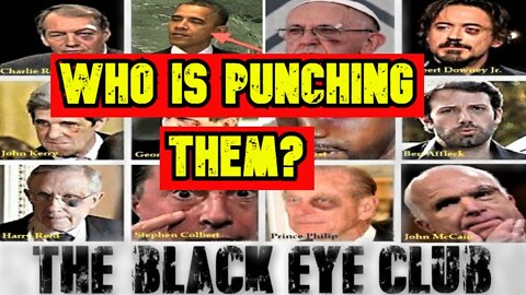 “Black Eye Club” Forever Victims Of The Globalist Cabal – Who Is Punching Them?