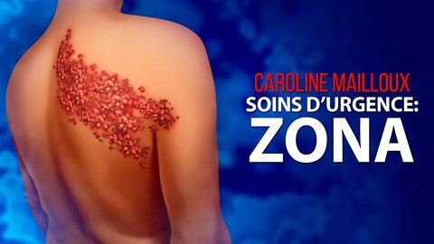 CAROLINE MAILLOUX - SOINS D'URGENCE: ZONA