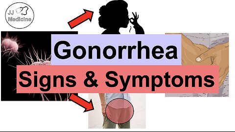 Gonorrhea Signs and Symptoms & Complications (& Why They Occur)