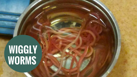 Live roundworms being removed from woman's bile duct