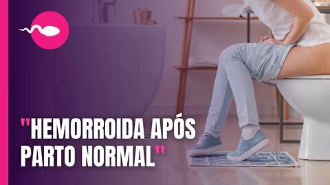 HEMORROIDA APÓS PARTO NORMAL, cuidado com as pomadas. Isso acontece devido a força para o parto…