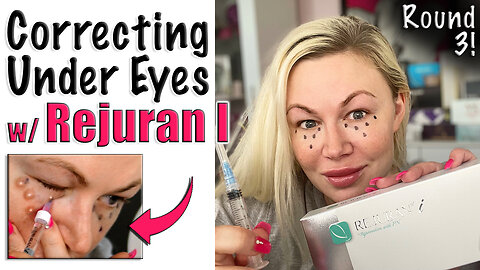 Correcting Under Eyes with Rejuran I, Round 3! AceCosm | Code Jessica10 saves you money!