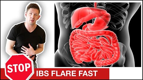 How To Stop An IBS Flare Up FAST || Irritable Bowel Syndrome Flare Up