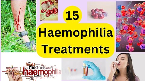 15 Haemophilia treatments