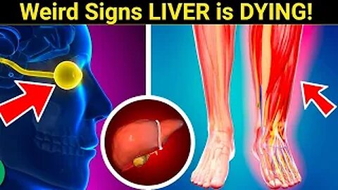 Shocking! 12 Unusual Signs Your Liver is Dying