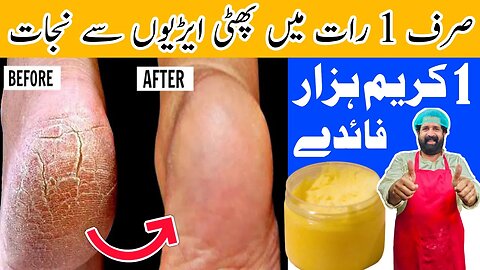 Remove Cracked Heels In Over Night | Get Beautiful Feet Permanently | White & Smooth Feet