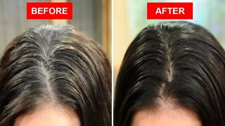 Home Remedies to Turn White Hair Black Without Chemical Dyes