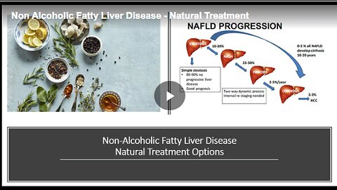 Treating NAFLD naturally