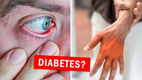 10 Early Signs of Diabetes You Shouldn't Ignore