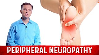 How to Relieve Peripheral Neuropathy Pain? – Dr. Berg
