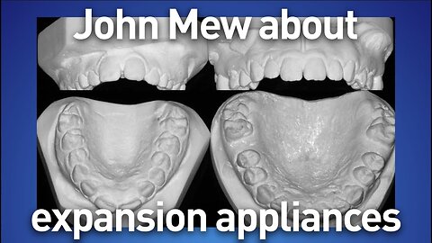 John Mew on expansion appliances