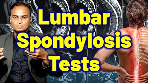 Tests and Investigations for Lumbar Spondylosis | Lower Back Pain Tests - Homeopathy Remedy & Cure