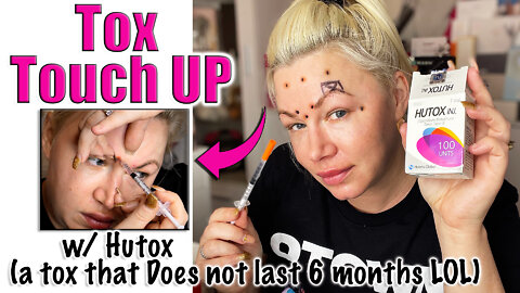 Toxin Touch up With Hutox from www.acecosm.com | Code Jessica10 Saves you Money!