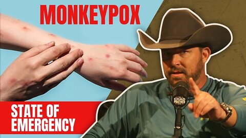Monkeypox: The Left's Latest Weapon of Control | The Chad Prather Show