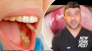 I'm a dentist – please don't ignore the 4 signs of mouth cancer as rates soar