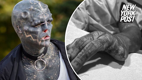 French 'black alien' reportedly gets fingers sliced off to create claw