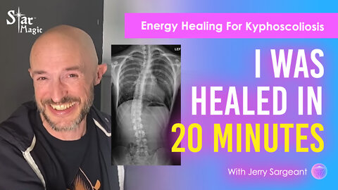 Rapid Energy Healing | Healed in 20 Minutes | Jerry Sargeant Testimonial | Kyphoscoliosis