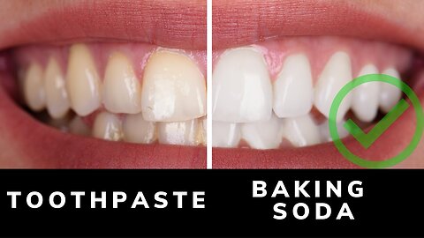 how to whiten teeth using baking soda