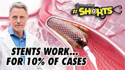 #SHORTS Stents Work... for 10% of Cases