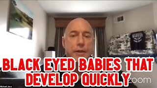Michael Jaco: Black Eyed Babies That Develop Quickly Are Here For The Parents That ..!!!!