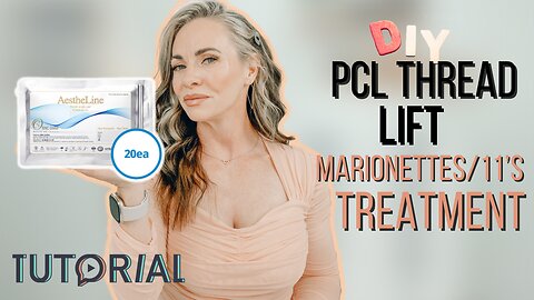 PCL Thread Lift to Build Collagen in My Marionettes and 11's