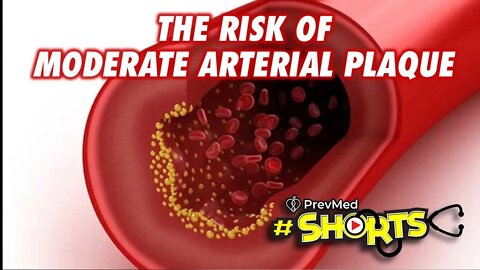 #SHORTS - THE RISK of Moderate Arterial Plaque