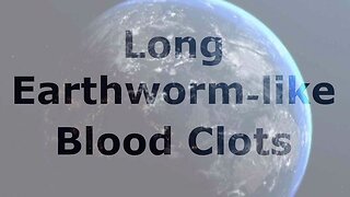 Long, Earthworm-like Blood Clots