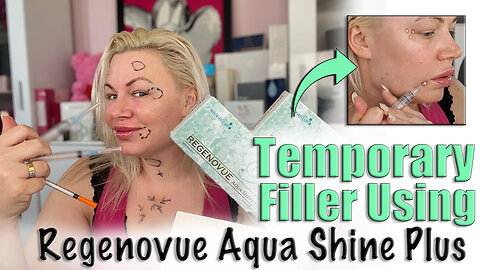 Temporary Filler Using Regenovue Aqua Shine Plus from AceCosm.com | Code Jessica10 Saves you Money!