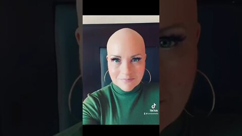 Wig vs Bald