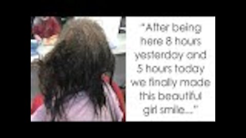 Hair stylist refuses to shave depressed girl’s matted hair