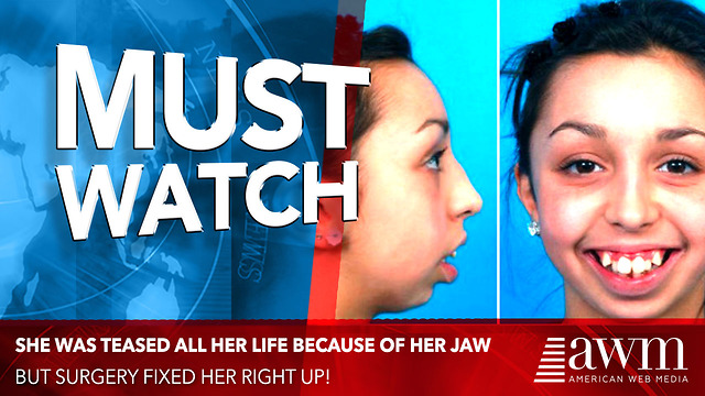 Girl Who Was Teased All Her Life Finally Gets Surgery. It’s Hard To ...