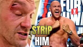 Tyson Fury is Destroying Boxing - Strip Him