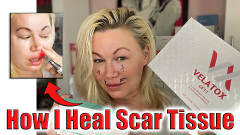 How I Heal Scar Tissue, an Easy DIY | Code Jessica10 saves you 10% off