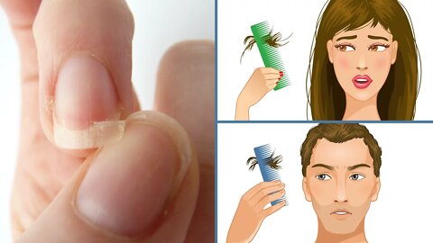 If You Have Thin Brittle Nails, Insomnia Or Hair Loss, Start Eating This!