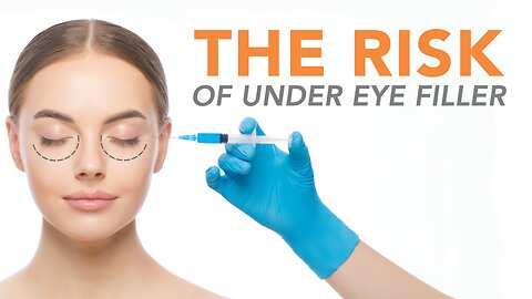 Risks of Under Eye Filler