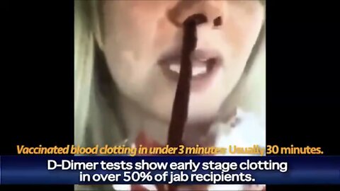 HORROR VIDEO: Covid-19 Vaccine is Auschwitz in a Syringe