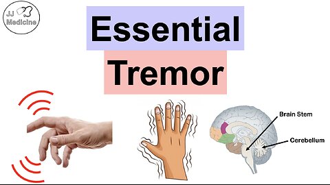 Essential Tremor | Causes, Pathophysiology, Symptoms, Exacerbating Factors, Diagnosis, Treatment
