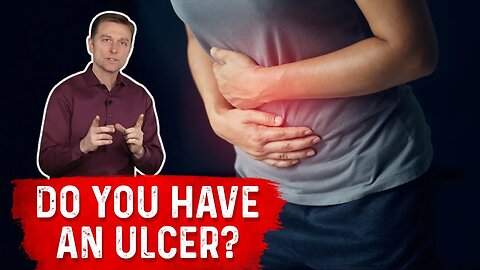 Understanding Ulcers: How Do You Know If You Have One? – Dr. Berg