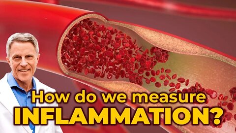 How do we measure inflammation?