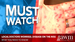 Local Doctors Worried After Spotting THIS Disease On The Rise